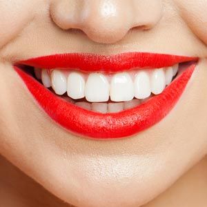 Woman in red lipstick — Wyoming, MI — Dental South