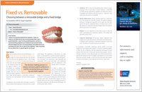 Fixed vs removable bridgework article  — Wyoming, MI — Dental South