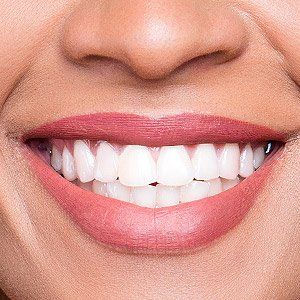 Woman showing her white teeth — Wyoming, MI — Dental South