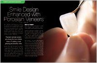 Smile design enhanced with porcelain veneers article — Wyoming, MI — Dental South