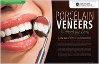 Porcelain veneers  without a drill article — Wyoming, MI — Dental South