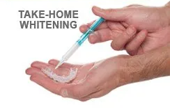 Teeth whitening method — Wyoming, MI — Dental South