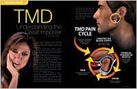 TMD  the great impostor article — Wyoming, MI — Dental South