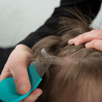 Checking for Lice — Birmingham, AL — Lice Clinics of Birmingham