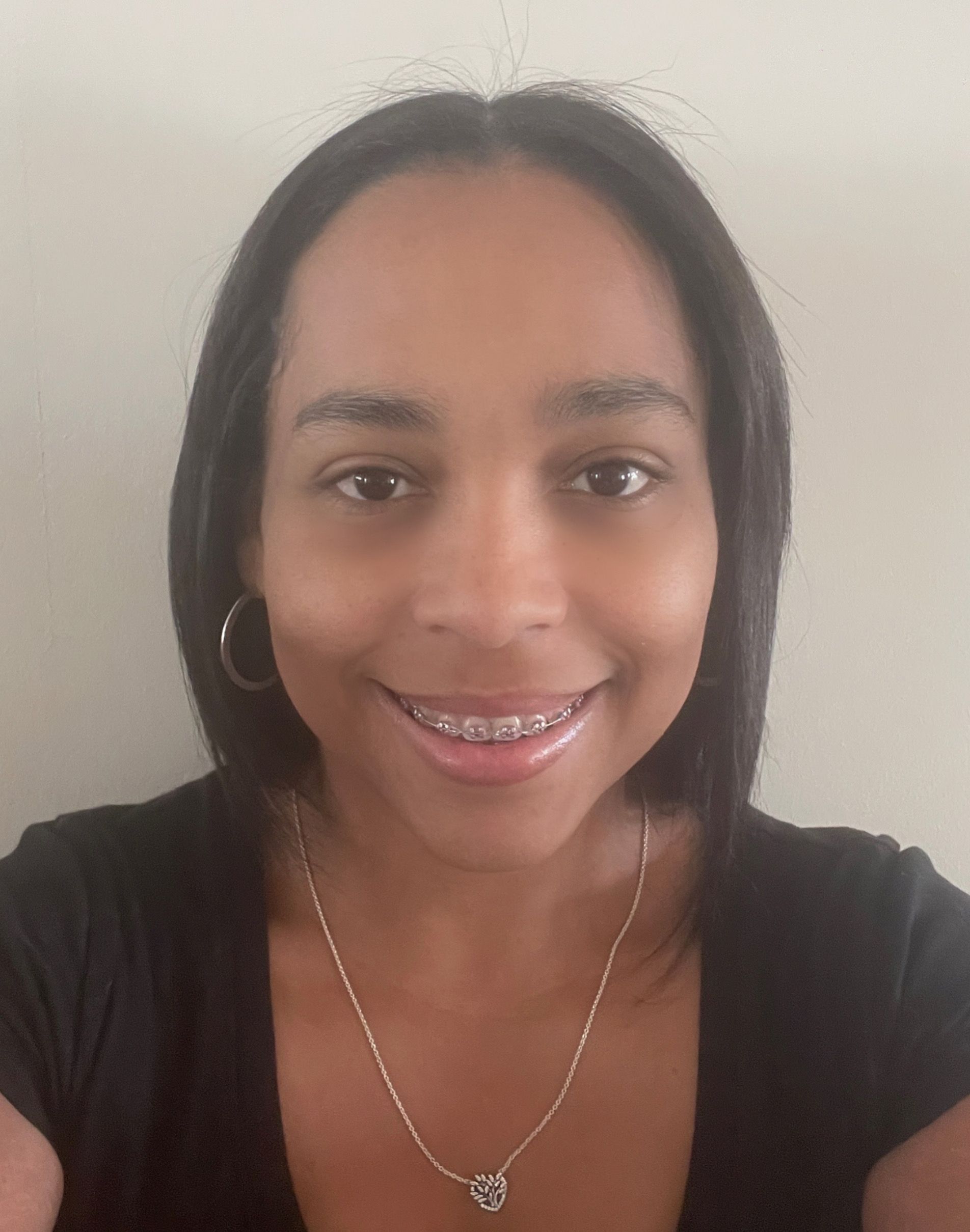 A woman wearing braces and a necklace is smiling for the camera.
