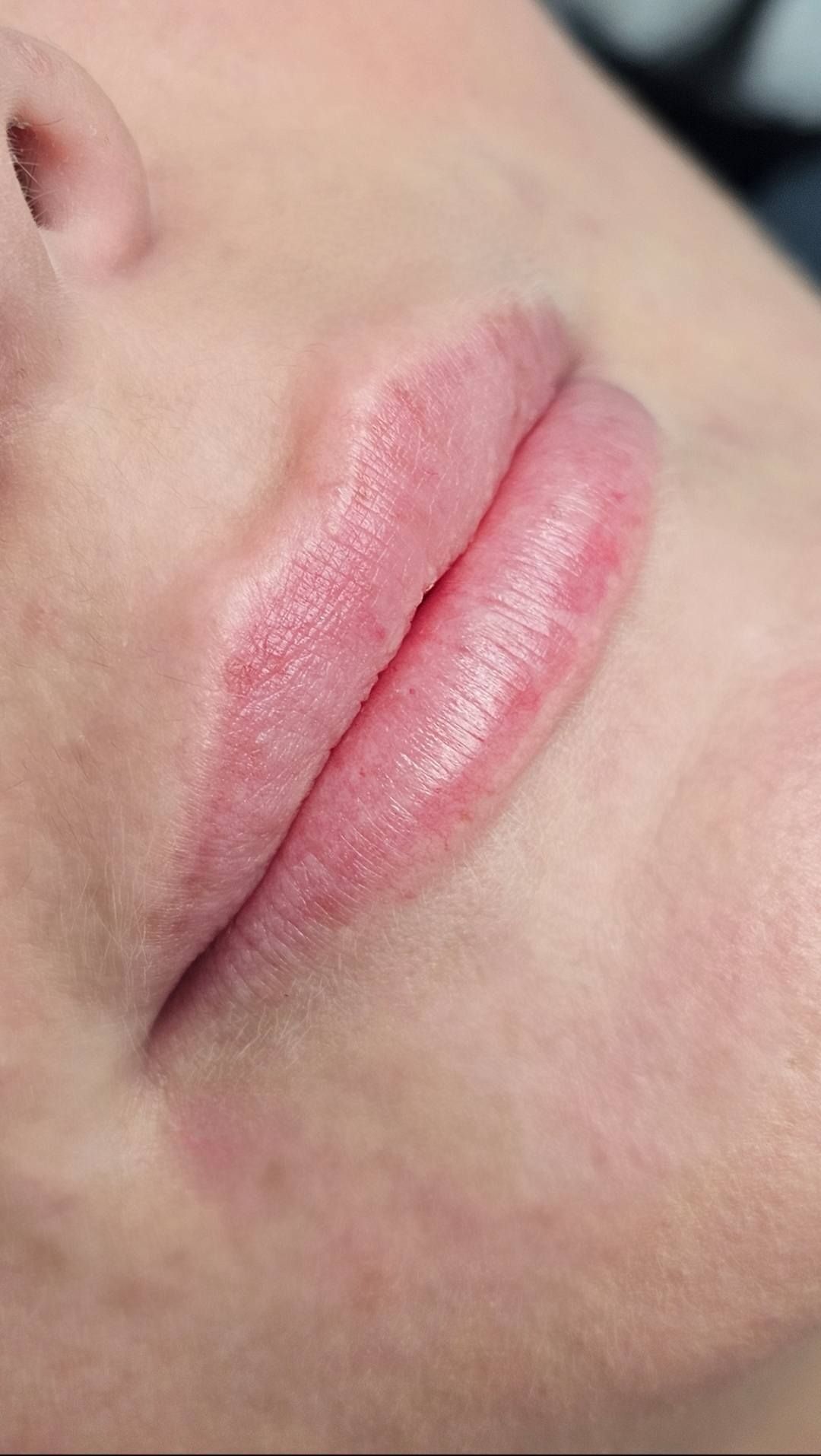 Close-up of a person's lips; they are pink, slightly glossy, and the skin around them is fair.