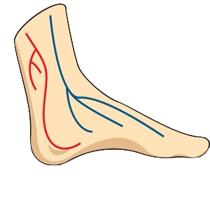 diabetes foot artwork clipart