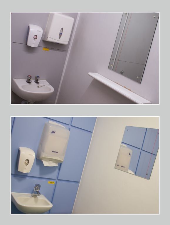 University Hospitals Bristol sink before and after