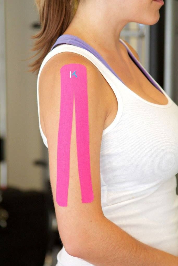A woman in a white tank top has pink kinesio tape on her arm.