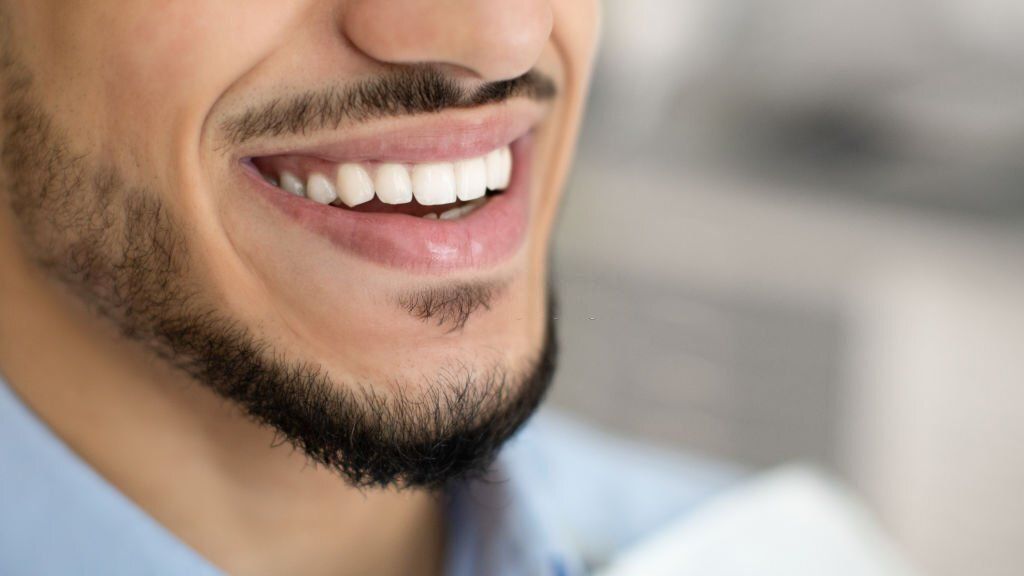 A man with a beard is smiling with his mouth open.