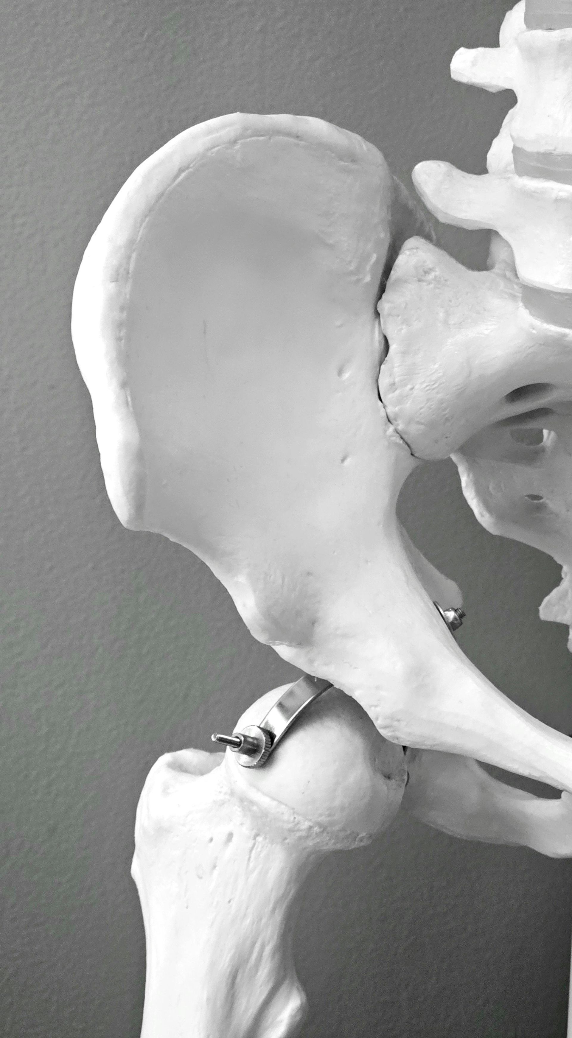 Pelvic anatomy model illustrating EMSELLA treatment target area
