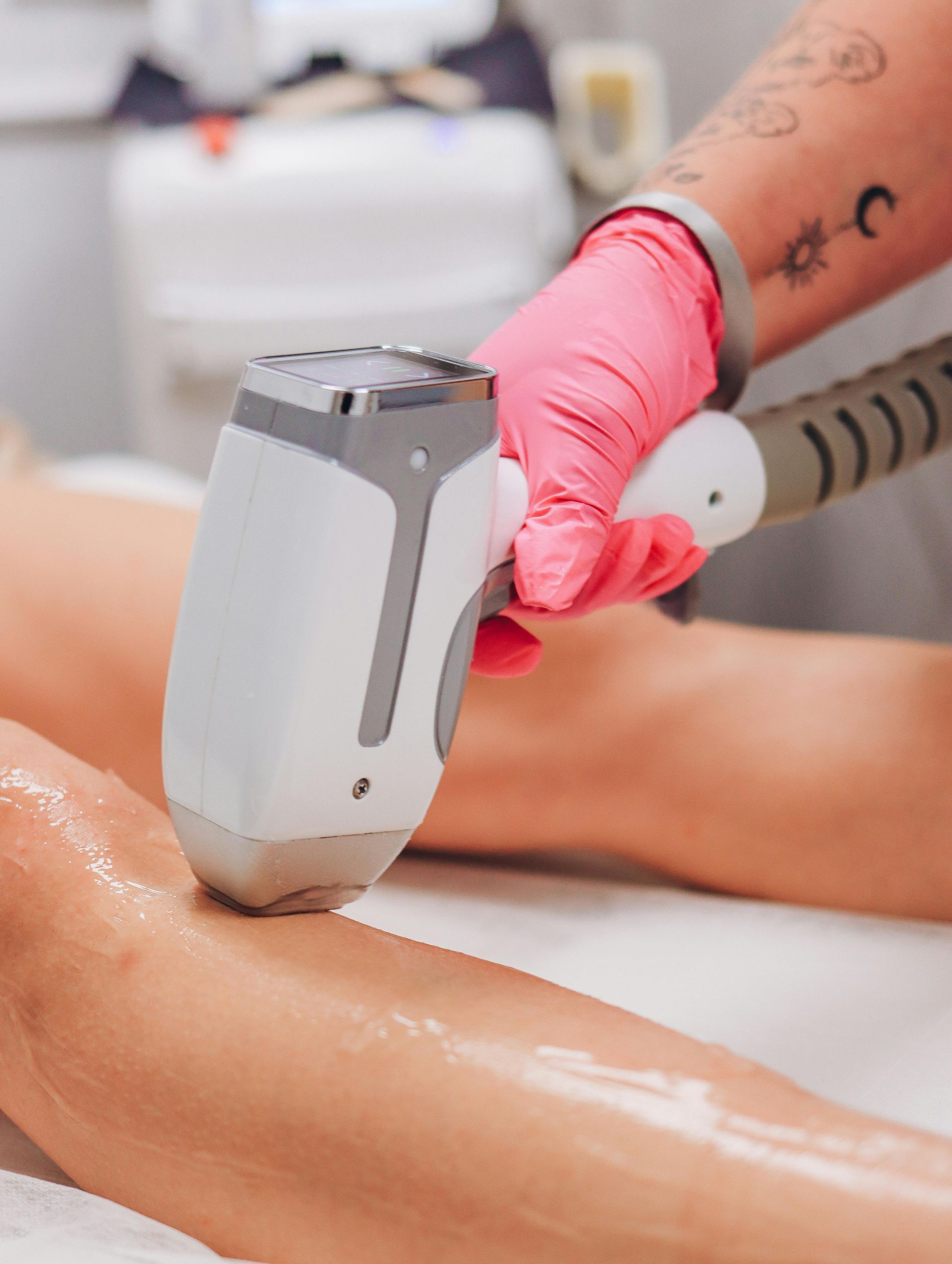 A laser equipment for removing tattoos