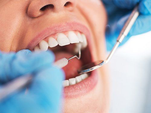 Emergency — Open Female Mouth During Oral Checkup At The Dentist in Bangor, ME