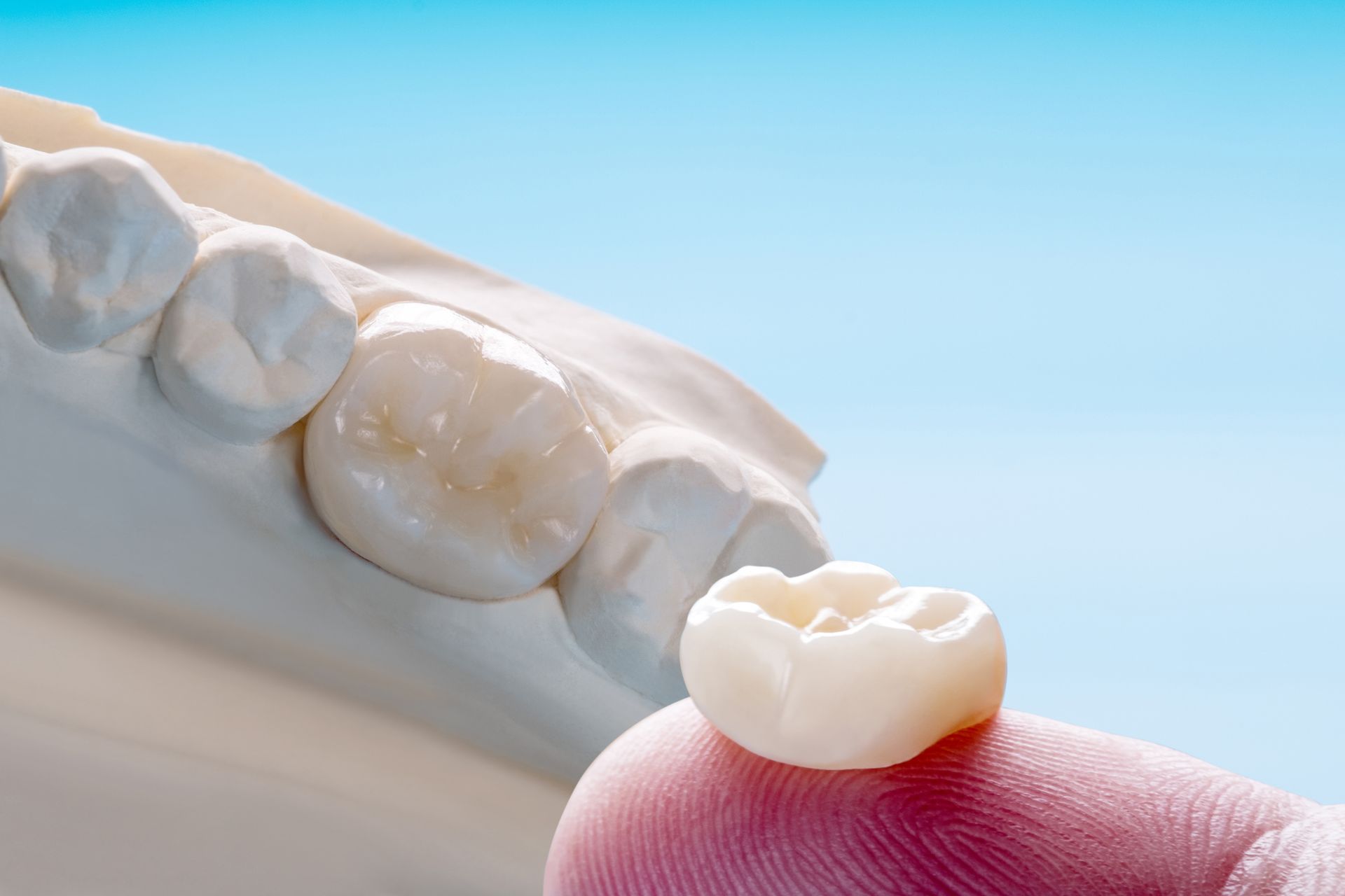 A Person Is Holding a Dental Crown on Their Finger in Front of A Model of Teeth.