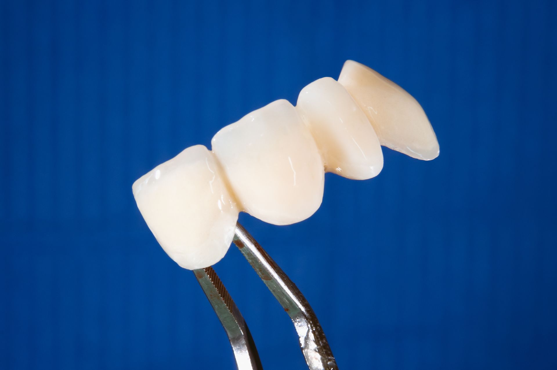 A Close up Of a Dental Bridge on A Blue Background.