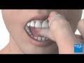 Why Do We Need To Floss Our Teeth : Live & Smile Dental & Orthodontics