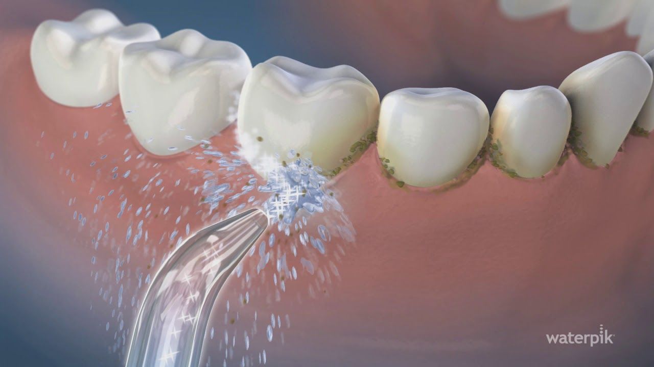 How Effective Are Waterpiks/ Water Flosser : Live & Smile Dental & Orthodontics