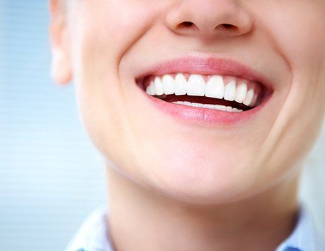 Smiling with White Teeth — Richardson, TX — Mark L. Ethridge, DDS