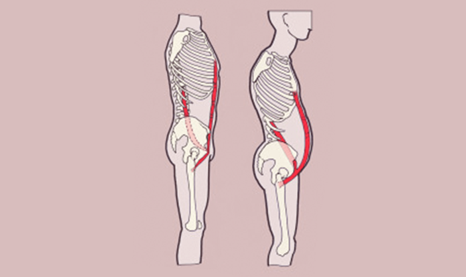 Psoas Major and Rectus Abdominis