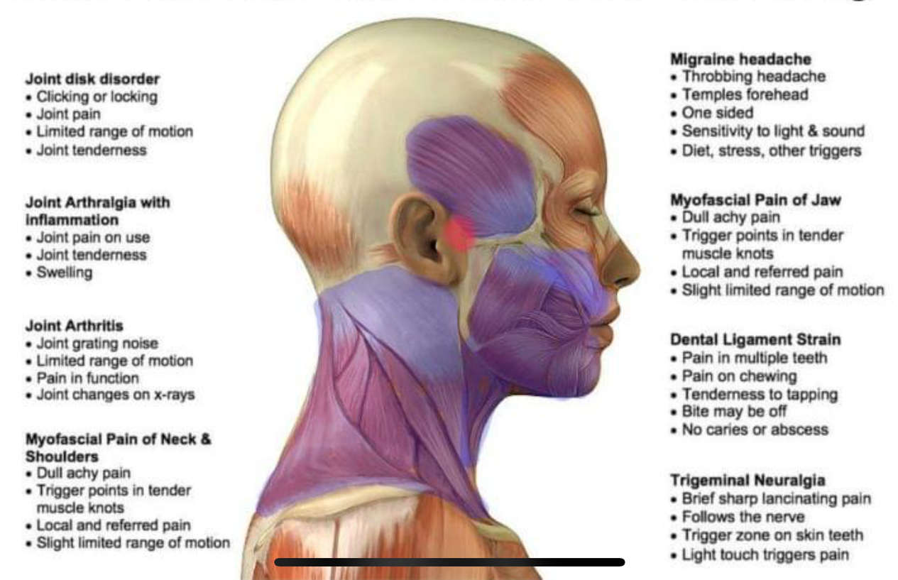 Medical illustration of head, neck, and shoulder muscles with conditions like migraines, joint pain, and neuralgia labeled.