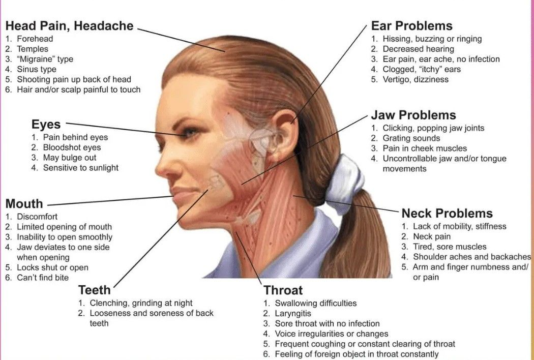 Diagram of a woman's face, with labels pointing to possible health issues like headaches, ear problems, and jaw pain.