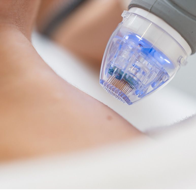 A woman is getting a laser treatment on her neck.