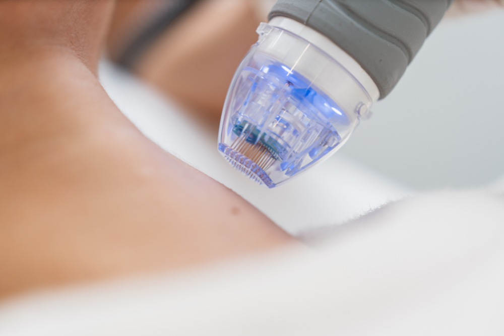A woman is getting a laser treatment on her neck.