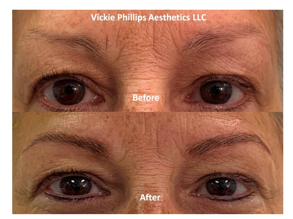 Before and after microblading example by Vickie Phillips Aesthetics