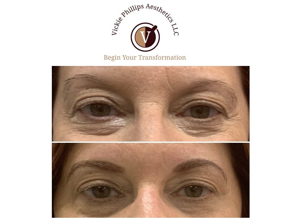 A before and after photo of a woman 's eyebrows