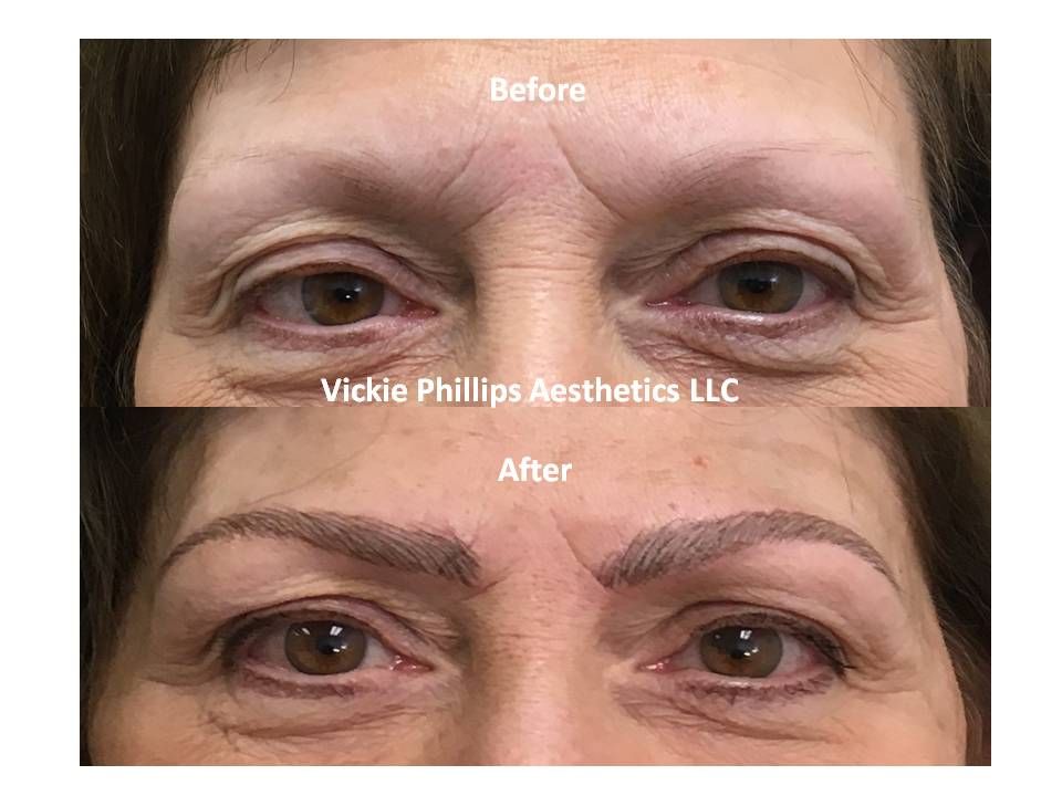 A before and after photo of a woman 's eyebrows.