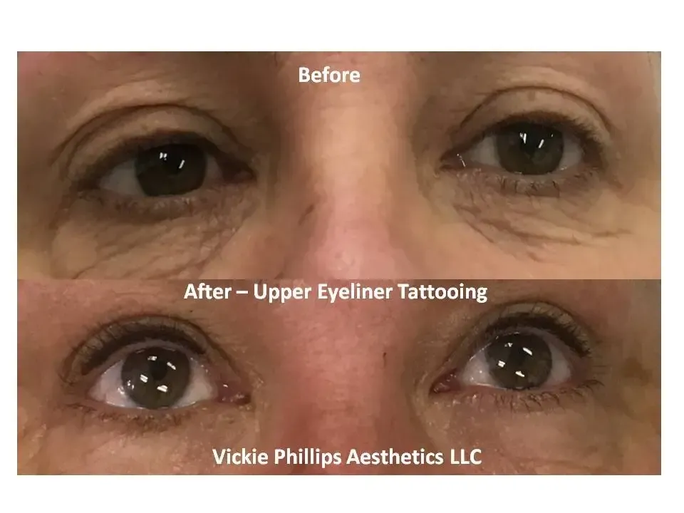 A woman 's eyes before and after upper eyeliner tattooing.