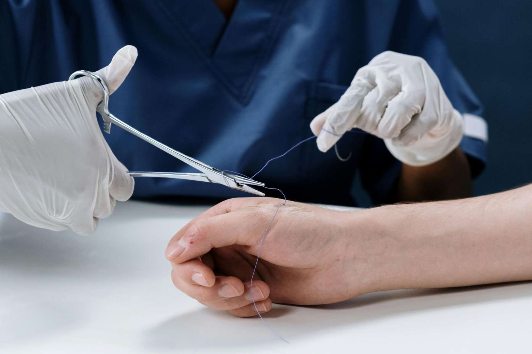 A nurse carefully treats a patient with a hand injury, demonstrating professional medical care in a clinical setting.