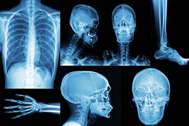 When Should You Go to the ER Instead?