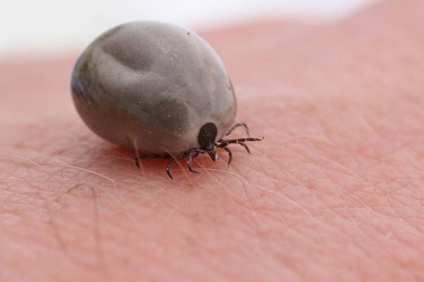 A tick biting a human.
