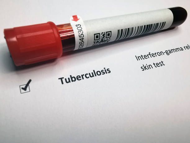 Understanding Test Results
