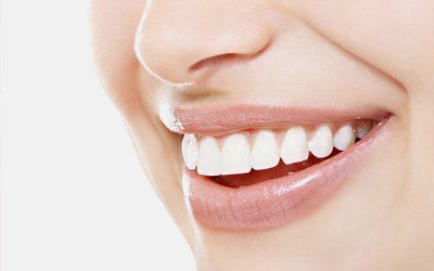 Teeth whitening procedures