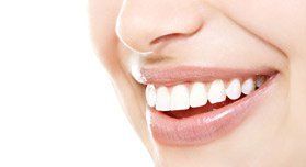 Teeth  whitening