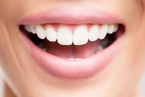TEETH WHITENING