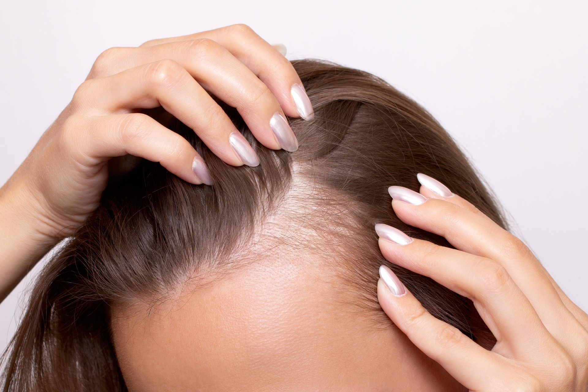 A person’s hands parting their dark hair to reveal dry, flaky scalp skin on a plain white background.