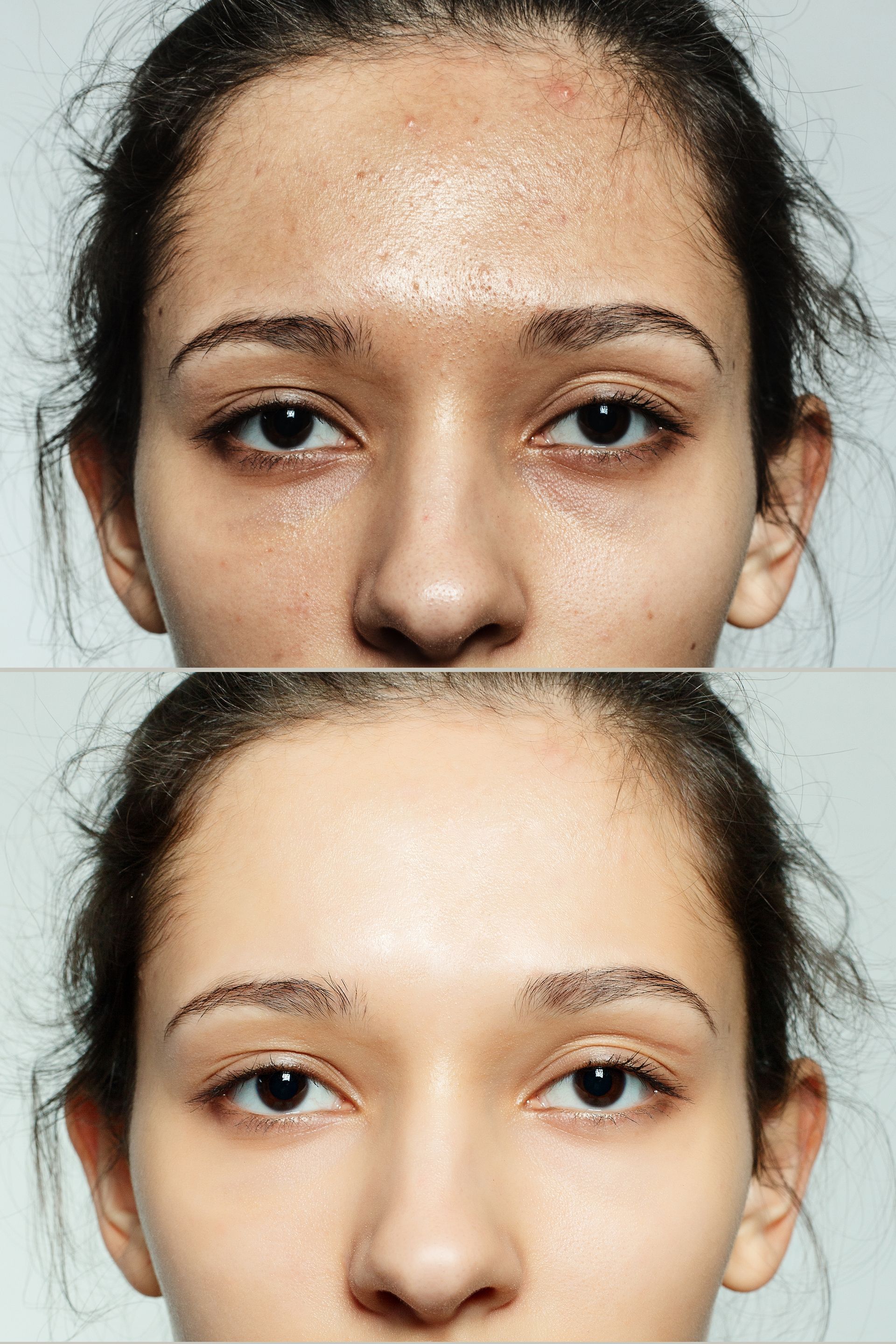 A before and after photo of a woman 's face with and without makeup.