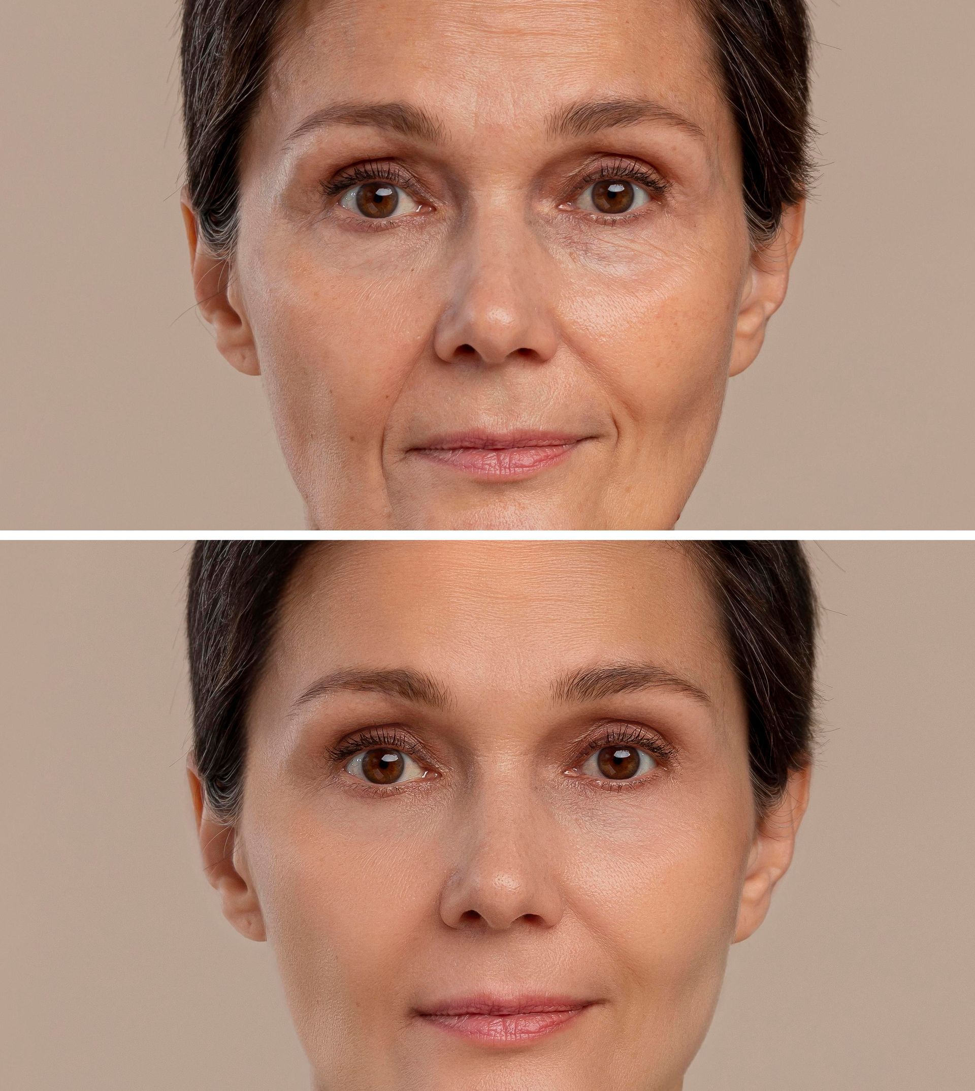 A before and after photo of a woman 's face.