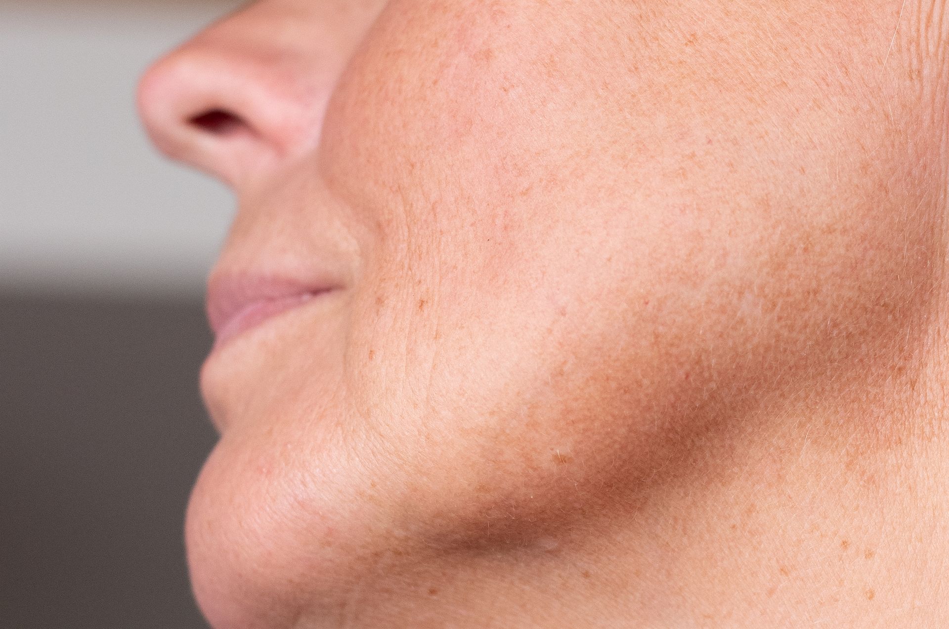 Close-up of a person's profile, showing nose, lips, and jaw. The skin has slight wrinkles and a warm tone.
