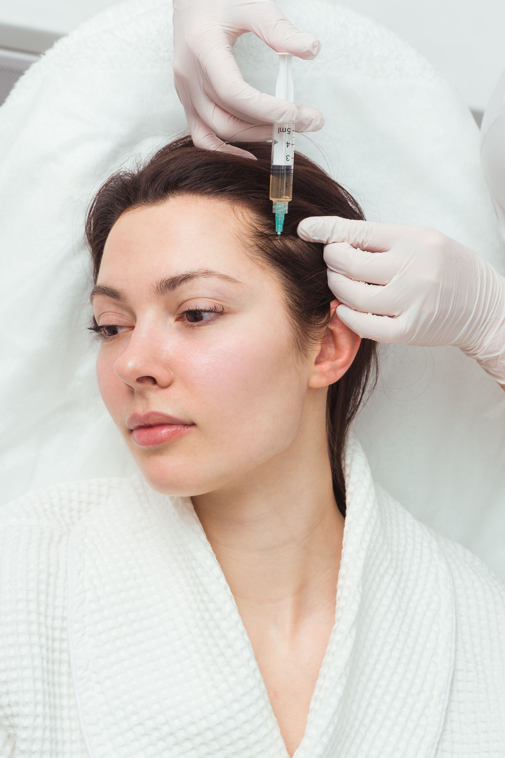 A woman is getting PRP Therapy for Hair.