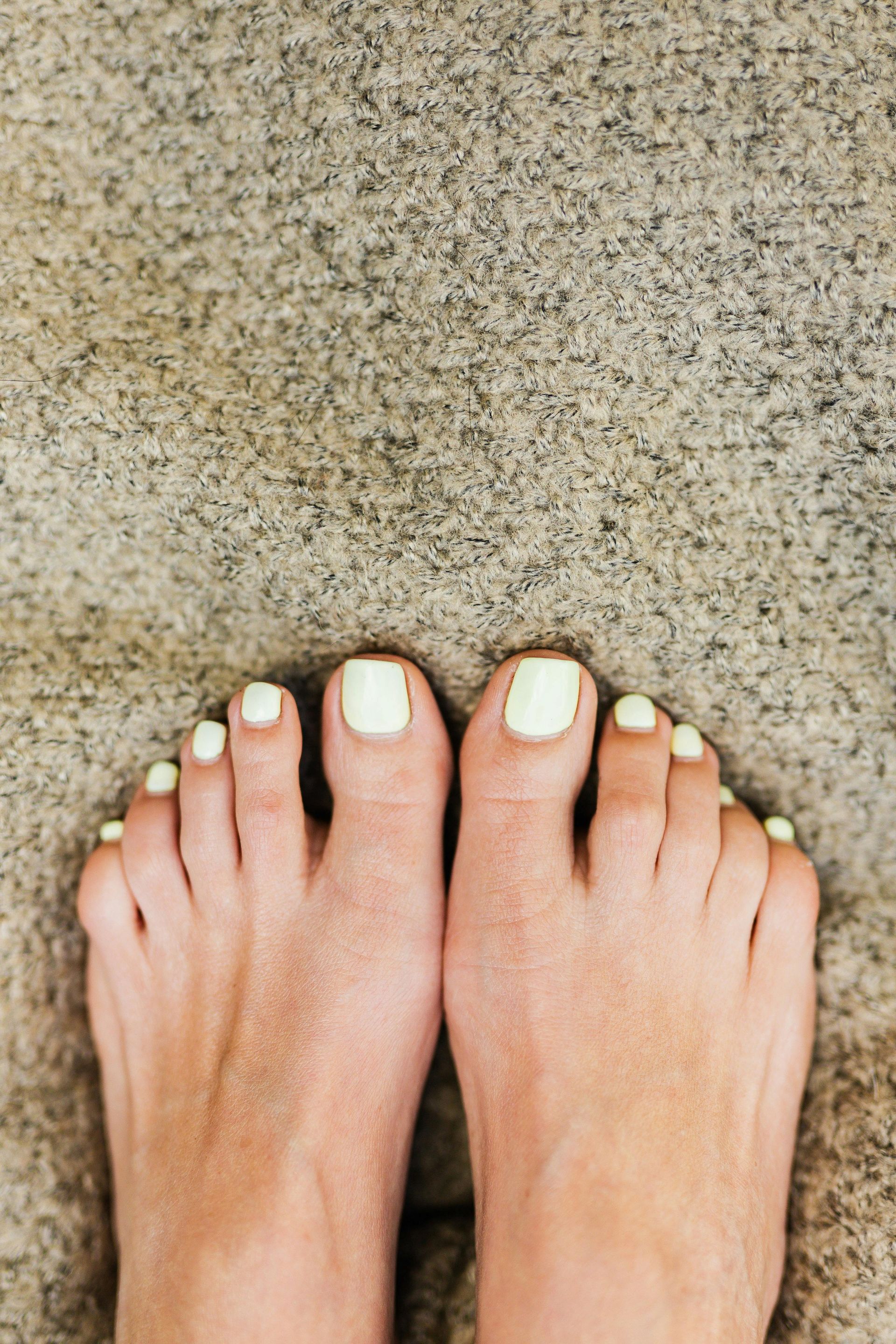 Bare feet with pale yellow nail polish on a mottled stone surface.