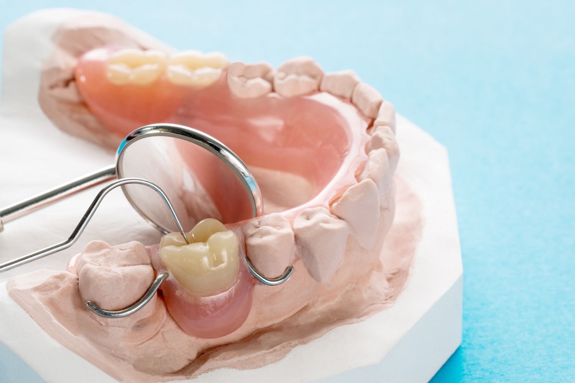 Artificial removable partial denture or temporary partial denture on blue surface. Artificial removable partial denture or temporary partial denture on blue surface.