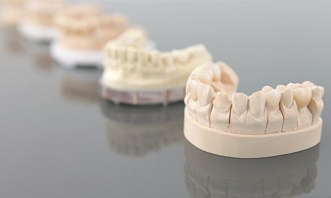 model of dentures