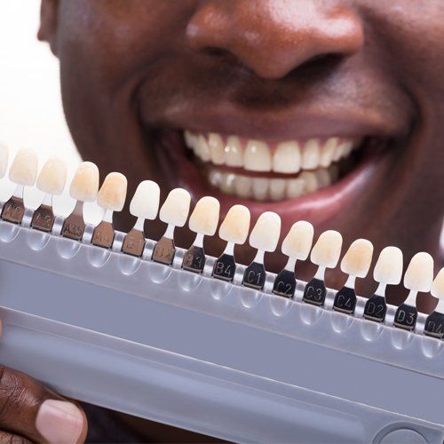 TN — Guy Choosing Color Tone For Teeth in Memphis, TN