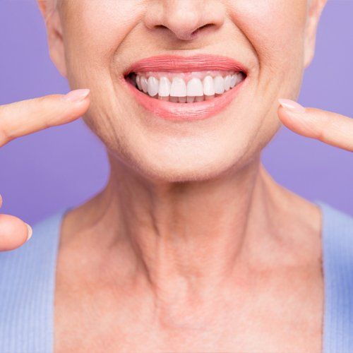Teeth Whitening — Periodontics in Memphis, TN