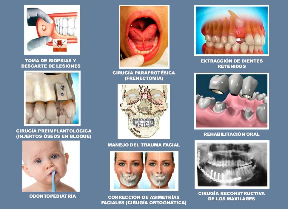 Odonto - GMA, clínica dental en Jesús María.