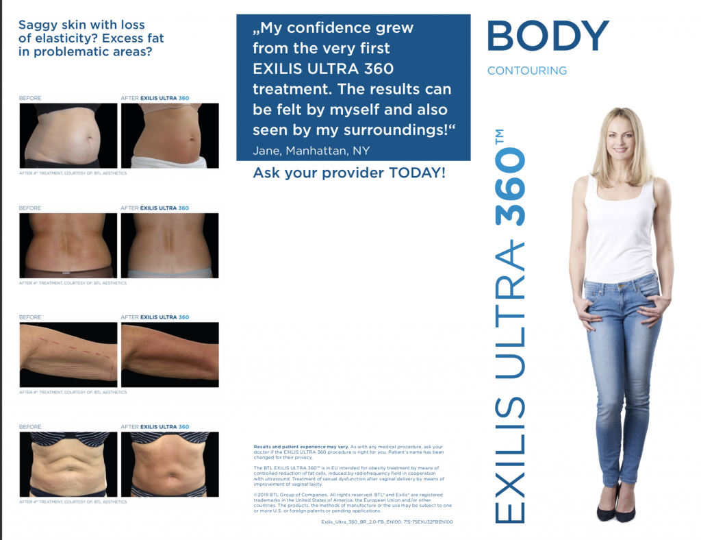 Exilis Ultra 360 Skin Tightening for Face and Body - Wall, NJ - Mirelle Anti Aging